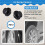 20 pcs  Lock Push Screw Pin Clips 6
