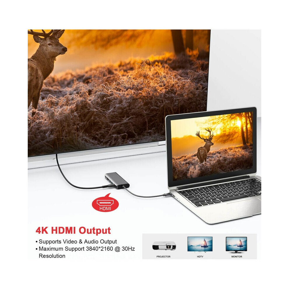 Multifunction Usb-C Hub For Macbook, Ultra Hd Video Display Adapter, High Speed Usb Ports, Gigabit Ethernet Connection, Sd Tf Card Reader, 3.5Mm 9169997062857