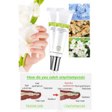 Nagelreparaturgel, Quick Effection Zehenpflege-Gel für sofortige Schönheit und Nagelwachstum, Nagelpflege-Essenzgel mit natürlichem Glanz