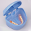 Dental Excellence, το κιτ καθαρισμού συγκρατητήρων οδοντοστοιχιών προσφέρει απαράμιλλη 3