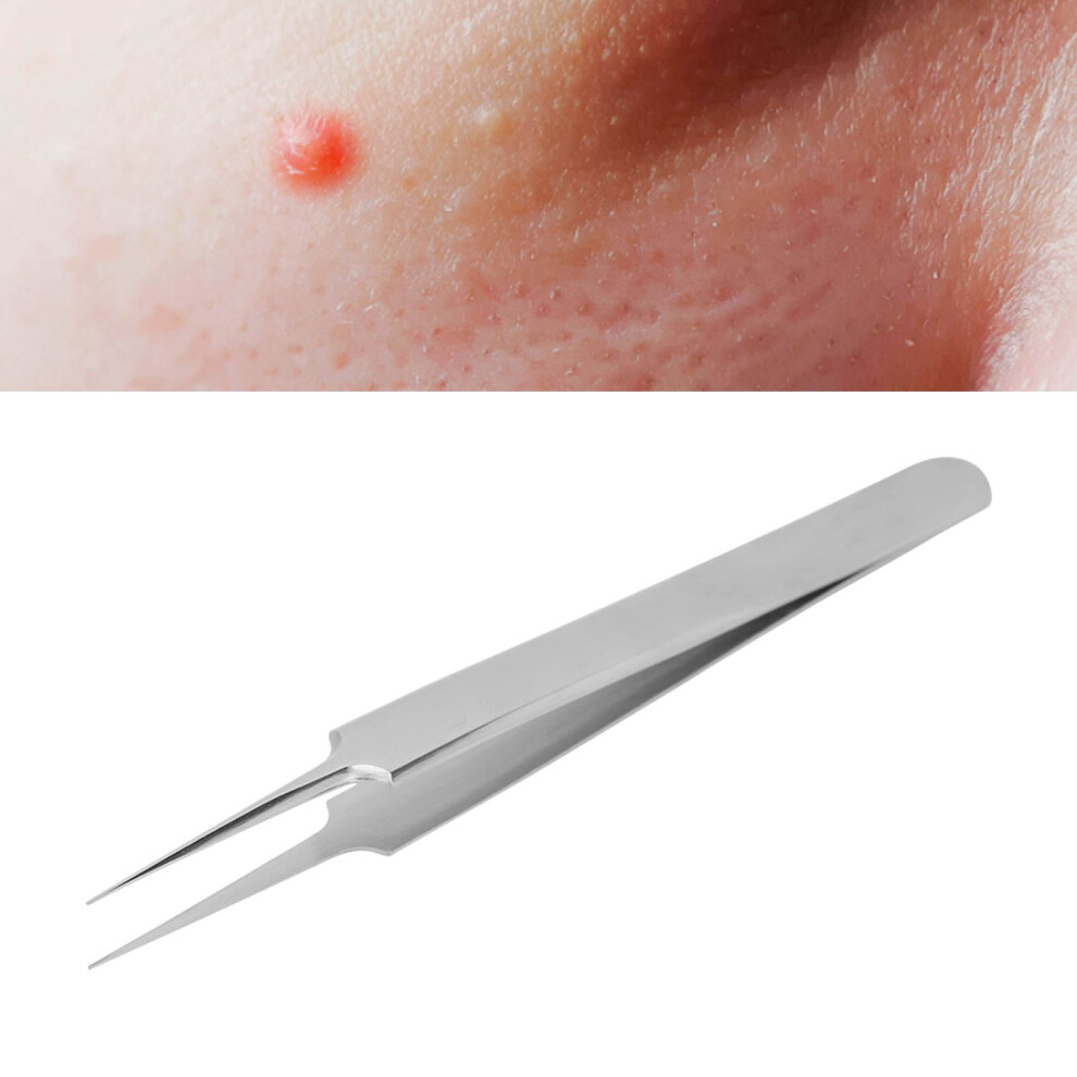 Stainless Steel Straight Head Pimple Popper Tool for Whitehead Removal
