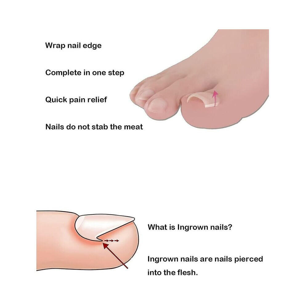 Complete Toenail Tool Set Including Ergonomic Design Ingrown Toe Nail Lifter, Professional Surgical Grade Stainless Steel Tools for Effortless Nail