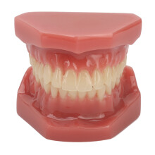 Modèle de traitement orthodontique avec bagues autobloquantes. Haute simulation. Outils pédagogiques dentaires réutilisables. Mâchoire flexible