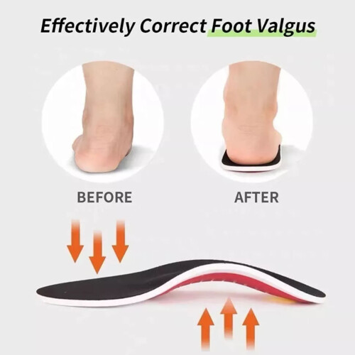Cuttable Arch Support Insoles with Valgus Bunion Sock Red L 41‑46