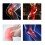 Sport Knee Brace Compression Sleeve 360 Wrap Adjustable Shock Support 9