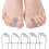 Toe Separator,Toe Corrector,2PCS Overlapping Toe Separators,Toe Separators,Large Toe Spacer,Toe Separator,Toe Separator,Hallux Valgus Toe Se 3