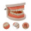 2Pièces Typodont Dents Rose PVC Pour Formation Consultation 11