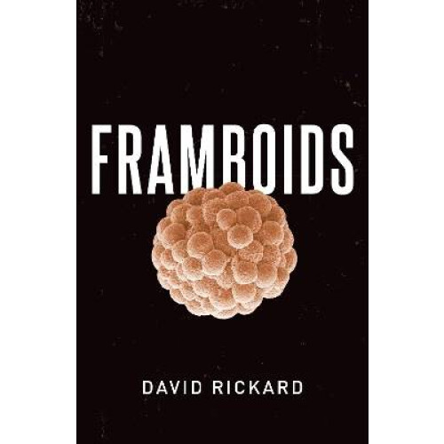 Framboids