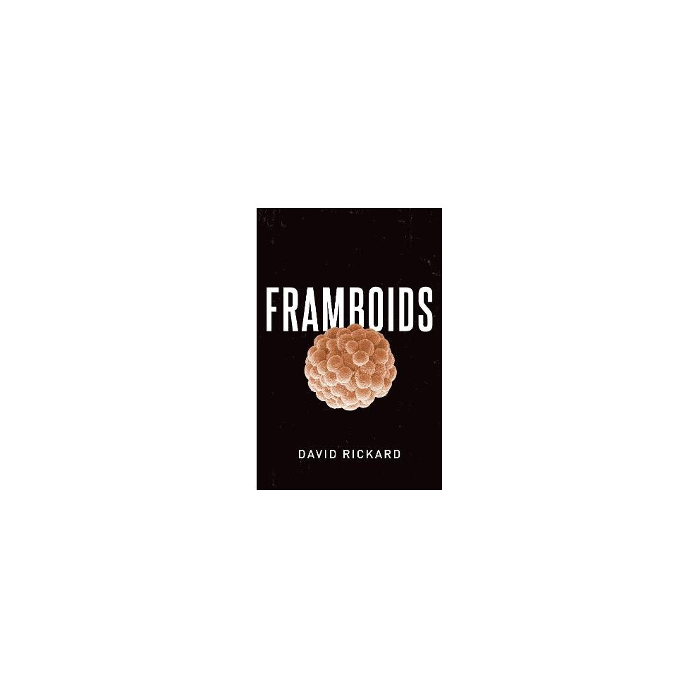 Framboids