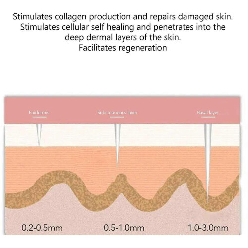 Στυλό κυλινδρικού βελονισμού Microneedling από ανοξείδωτο ατσάλι 03mm, κυλινδρικό στ 1