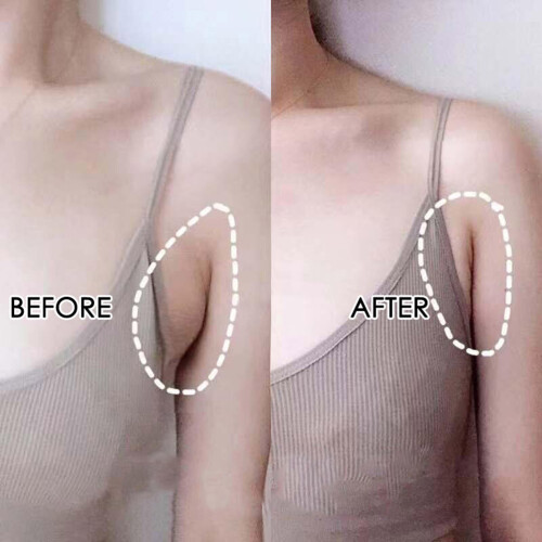 Neck Lymph Node Patch, Underarm Patch Featuring Free Cutting Flexibility, Herbal Lymph Care Patch for Targeted Lymphatic Drainage Support, Natural 2