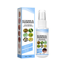 Behandeling van psoriasis, door artsen aanbevolen shampoo voor seborroïsche dermatitis, verlicht langdurig jeuk, vermindert roodheid,
