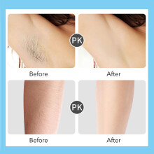 Rechargeable Pink Electric Hair Epilator with Detachable Head for Women & Men