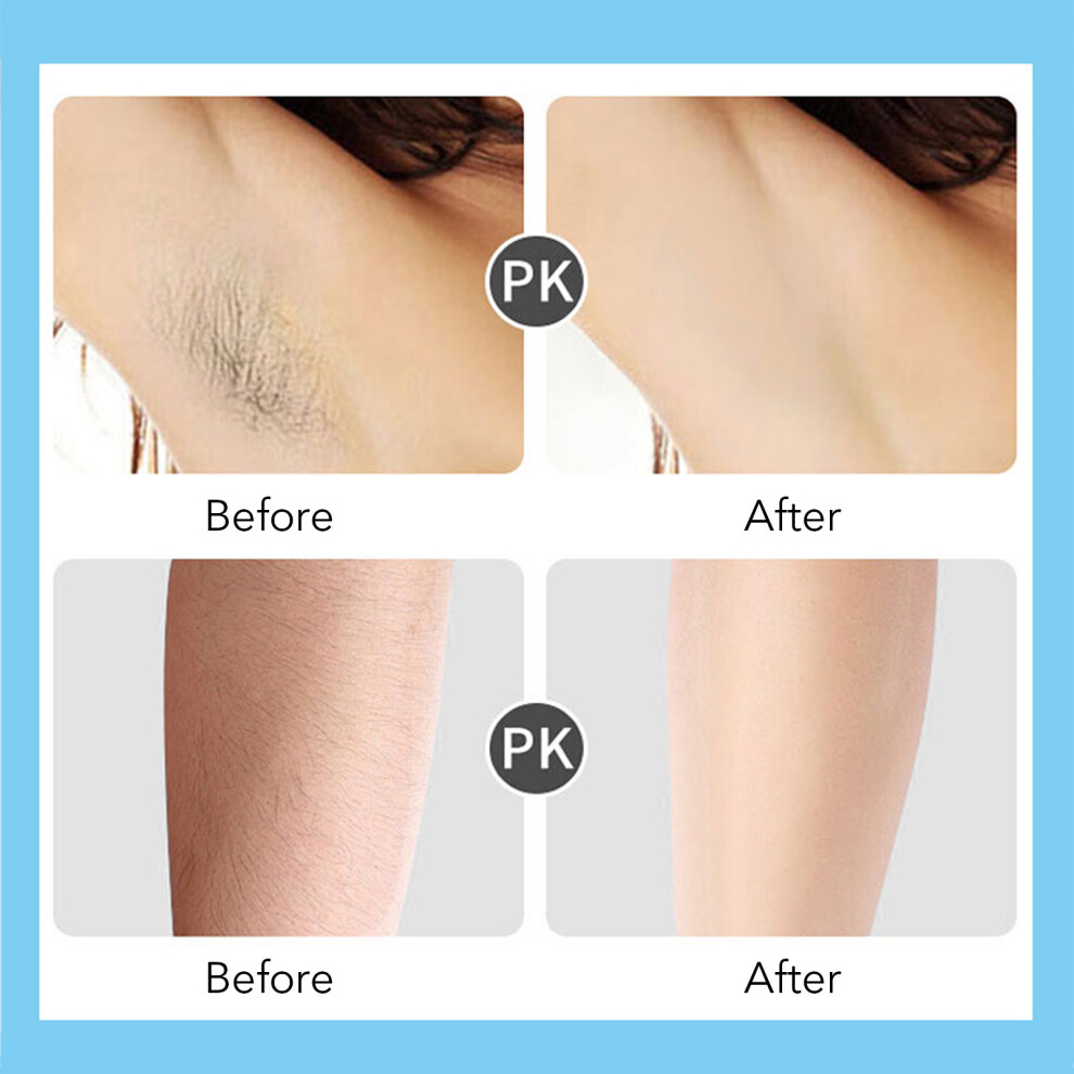 Rechargeable Pink Electric Hair Epilator with Detachable Head for Women & Men