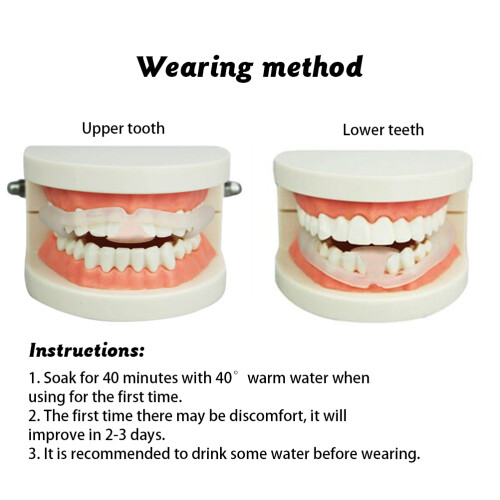 Anti Molar Braces for Teeth Grinding Relief 1