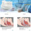 PC+EVA Adjustable Braces to Alleviate Grinding and Improve Sleep Tools 4