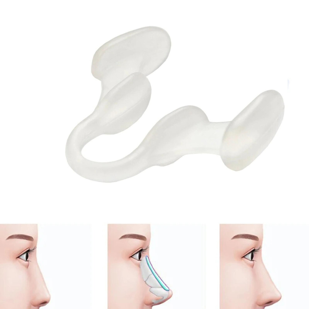2pcs Anti Snoring Nose Dilator, Nose Clip for Better Breathing, Snoring Aid Solution