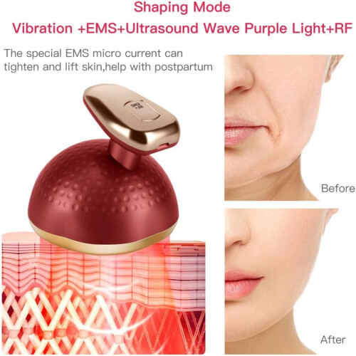 Body Slimming Machine RF MultiFunctional Fat Burning Device, EMS Microcurrent, 3 Gears, 3 Color Light Modes, White 1