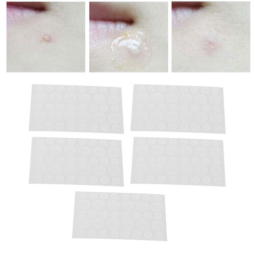 Fast Acne Removal with 5Pcs Hydrocolloid Patches - Quick Healing