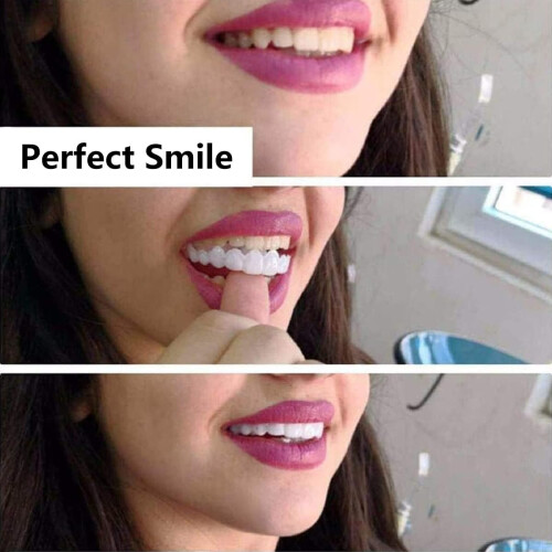 Veneers for Missing Teeth, Instant Veneers Dentures  and Bottom, Natural Smile Cover 2