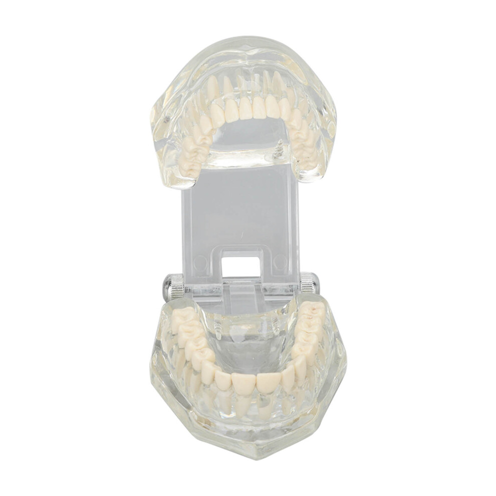 Clear Acrylic Dental Teeth Model for Teaching & Display in Clinics