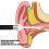 LED Ear Penlight with Ear Pick, Fitting Tool for Doctors & Nurses 3