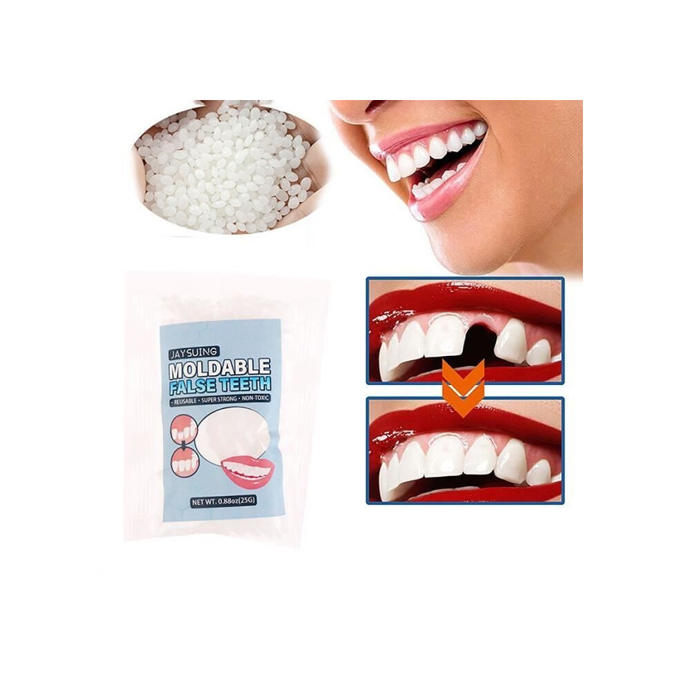 Aihontai Temporary Resin Tooth Repair Kit, False Teeth, Strong Glue, Denture Adhesive - One Size[E9]