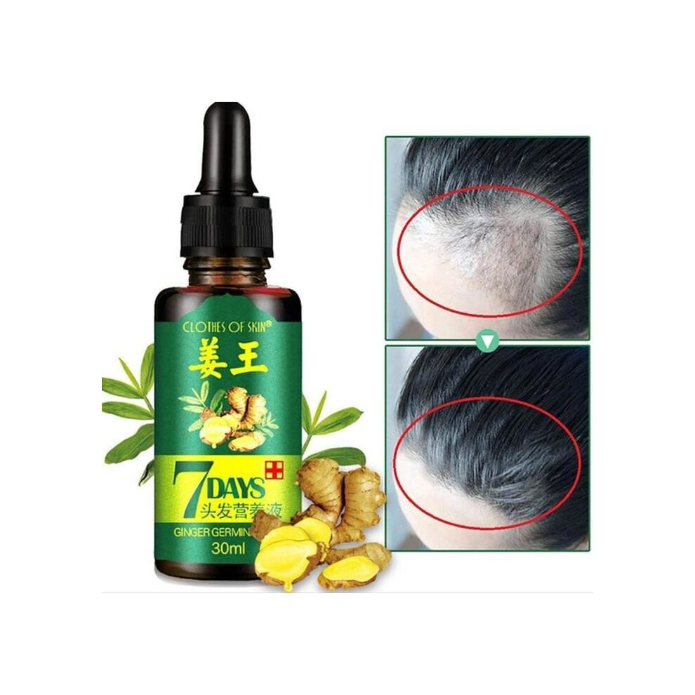 Aihontai Anti Hair Loss, Hair Growth Serum, Natural Herbal Hair Growth Serum, Help Hair Growth