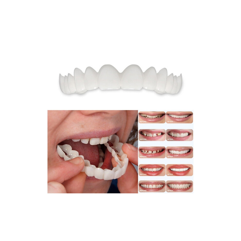 1PC Temporary Top Veneer Dentures for Instant Smile and Confidence