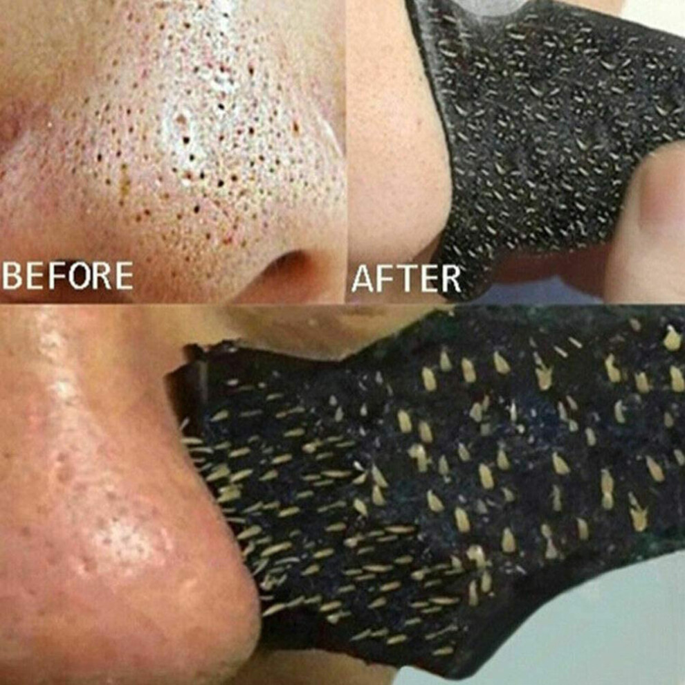 10Pcs Deep Cleaning Nose Pore Strips for Blackhead Removal Blackhead Remover