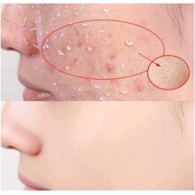Gesichts-Exfoli gel 100ml aufhellend & feuchtigkeitsspendend Gesichtspeeling