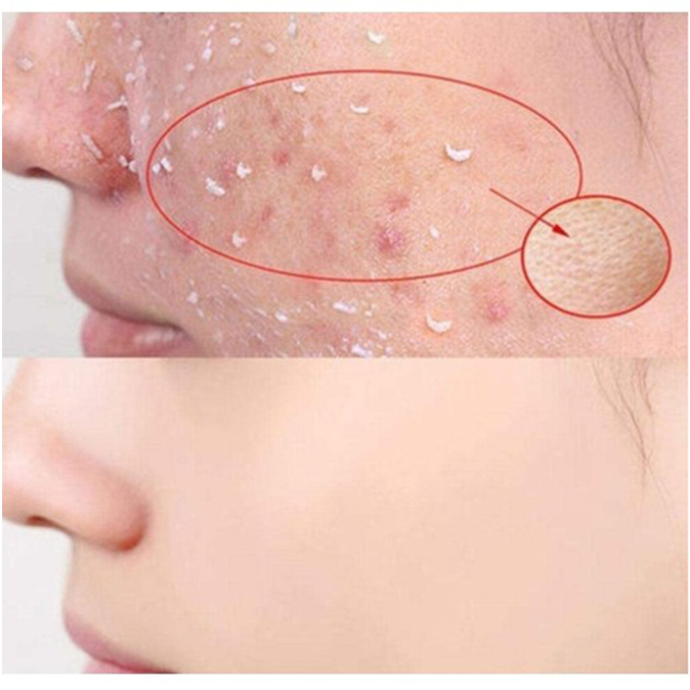 Face Exfoliating Gel 100ml - Brightening, Moisturizing & Deep Cleanser