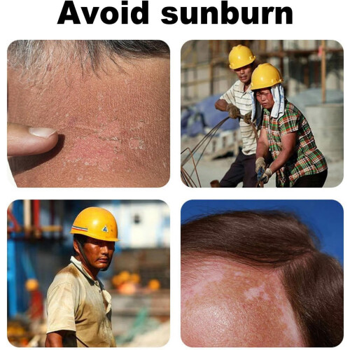Hardhat Sun Shade Neck Shield, Breathable Cooling Hard Hat Protector For Welding, Material Handling, Universal Fit 2