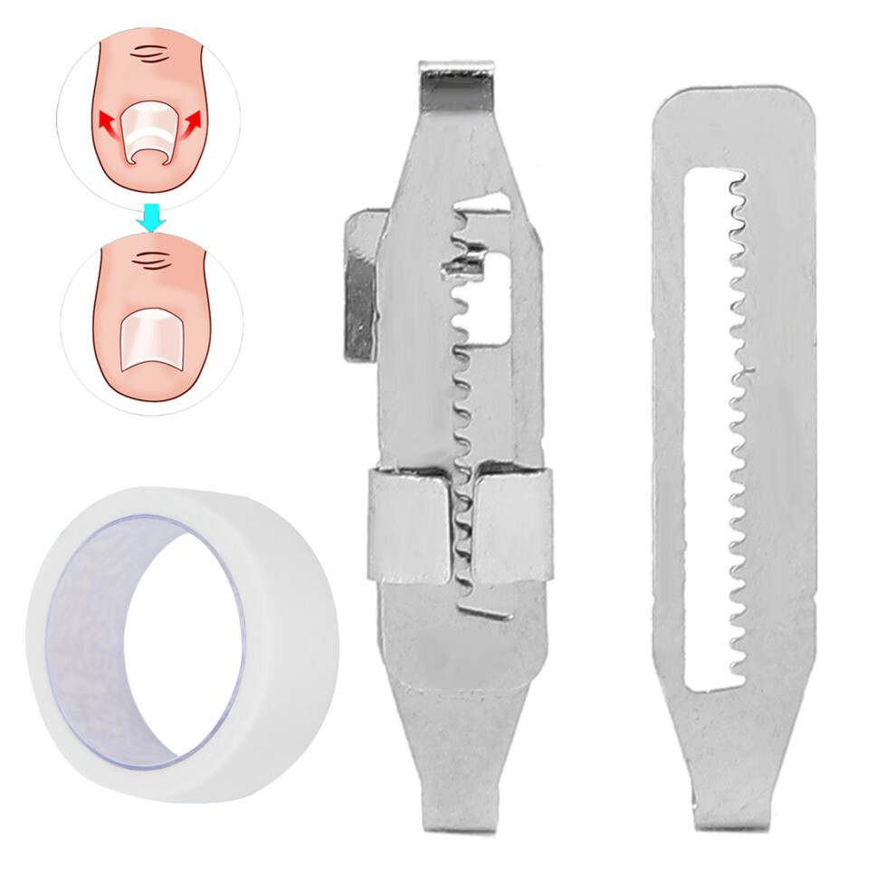 Stainless Steel Ingrown Toenail Correction Clip Tool for Men & Women