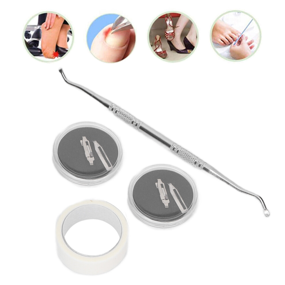 Ingrown Toenail Correction Tool 2pcs Relieve Pain & Redness Quickly