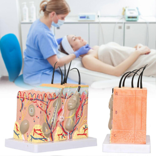 3D Skin Model, 35X Enlarged Human Anatomical Skin Model for Science Classroom Study Display Teaching Tool 1