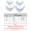 Cute Adjustable Cat BowTie Collars Cat Collar-black strips L 2
