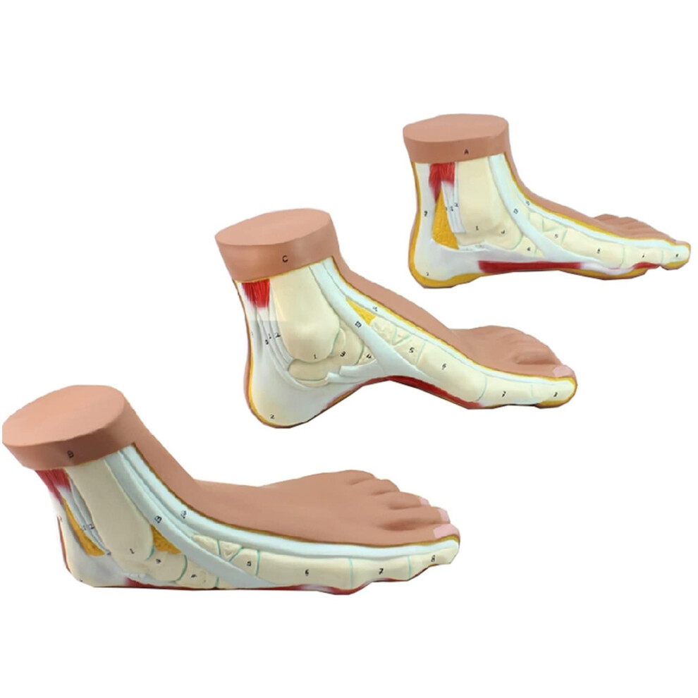Anatomical Model Foot Normal Arched Flat Foot Cavus Foot Model Life Size Foot Joint Skeleton Model Rehabilitation
