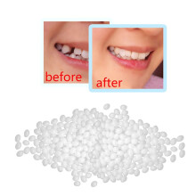 Esferas térmicas para preencher espaços entre dentes quebrados e ausentes. Kit de reparo dentário temporário com processo de moldagem fácil e