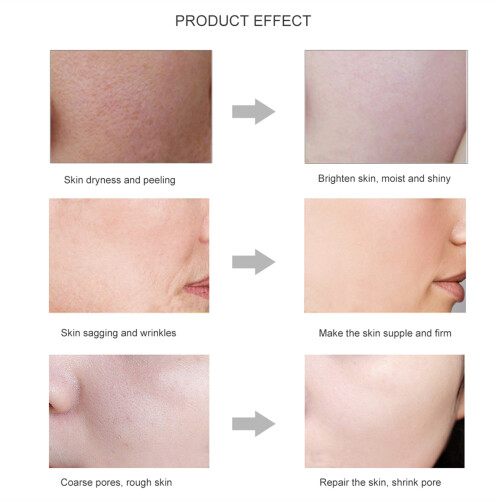 Elegant Gold Essence Serum, Αντιρυτιδική Θεραπεία για Βελτιωμένη Ελαστικότητα Δέρματος, 2