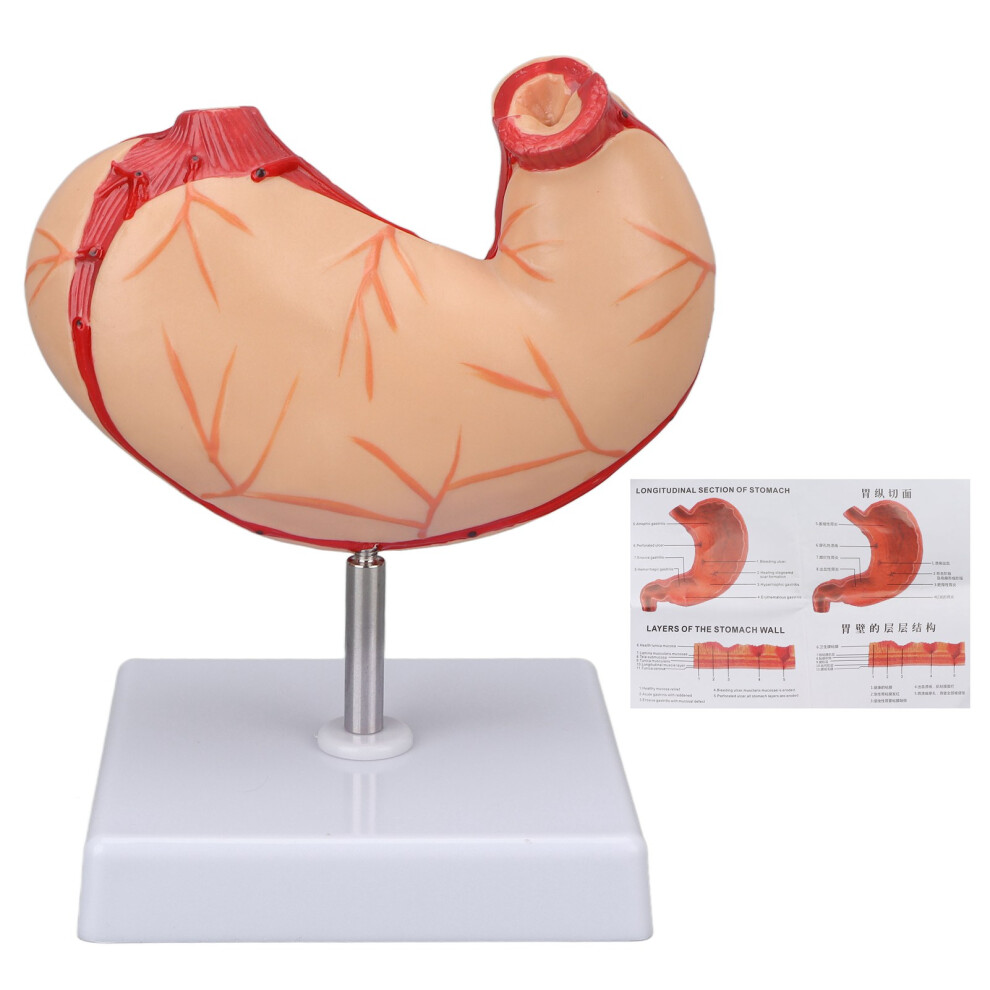 Stomach Teaching Model For Medical Research And School Instruction, Realistic Plastic Human Stomach Anatomical Model With Durable Non-Toxic Material