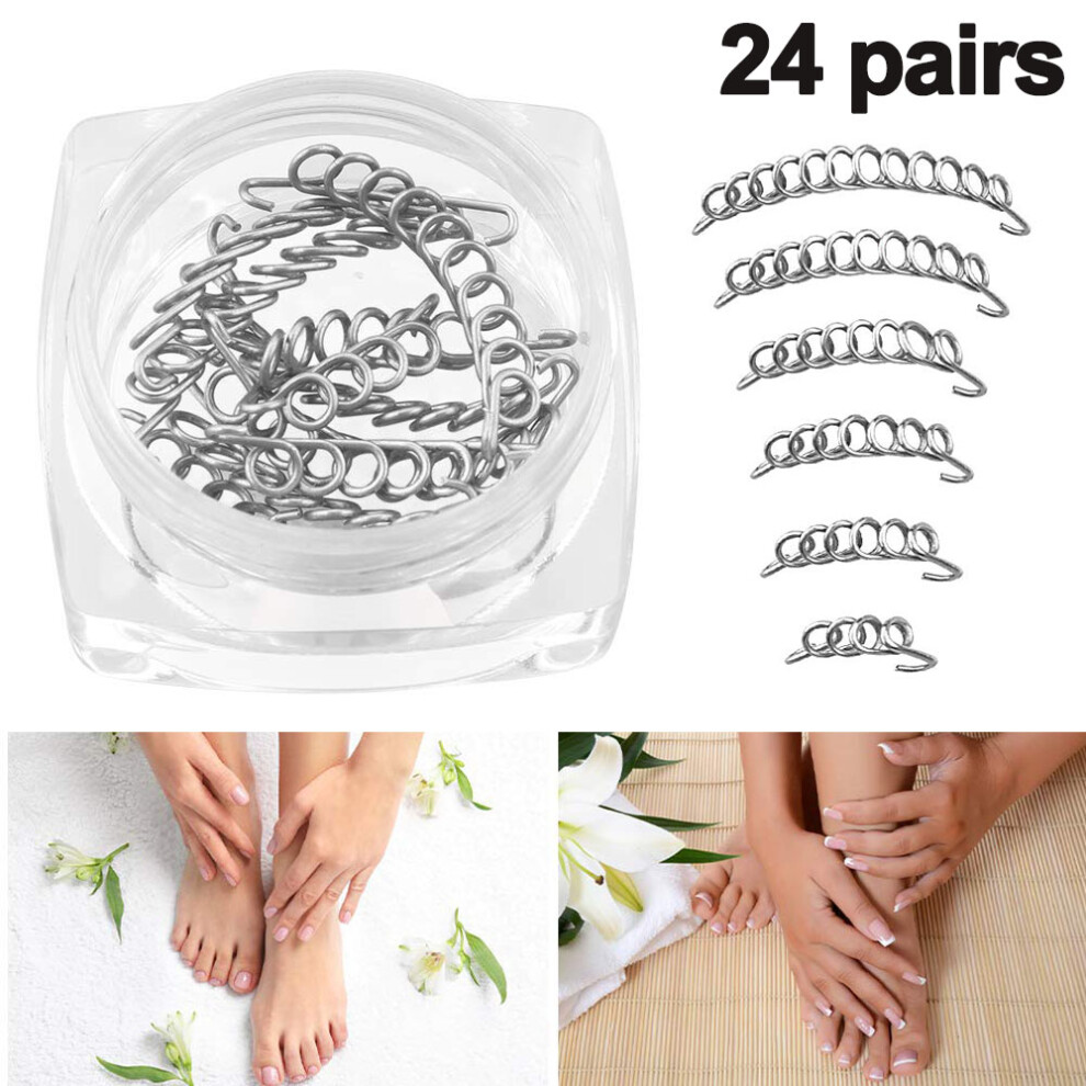 Compact Ingrown Toenail Corrector For Travel Physical Correction Tool With Long-Term Effectiveness For Halloween Parties For Nightclubs For Daily Use