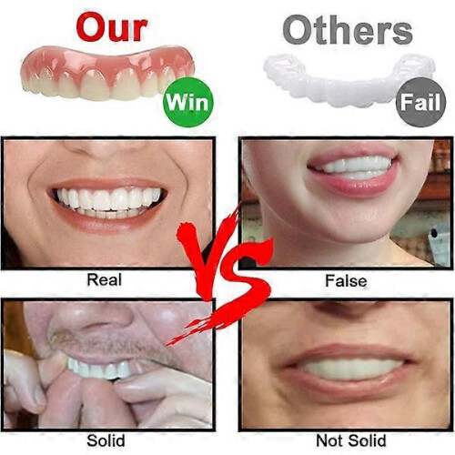 Upper/lower dentures perfect smile veneer dentures 1
