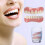 Upper/lower dentures perfect smile veneer dentures 4