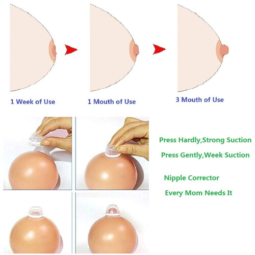 CareforYou 2Pair Nipple Corrector for Flat Inverte 2