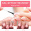 Benaewa 2 Pcs Nail Biting Prevention for Kids and 2