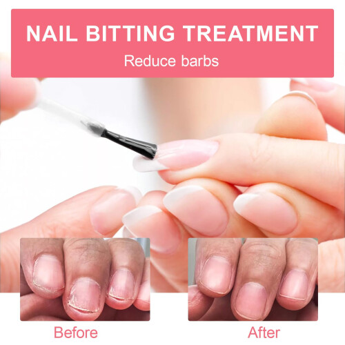 Benaewa 2 Pcs Nail Biting Prevention for Kids and 1