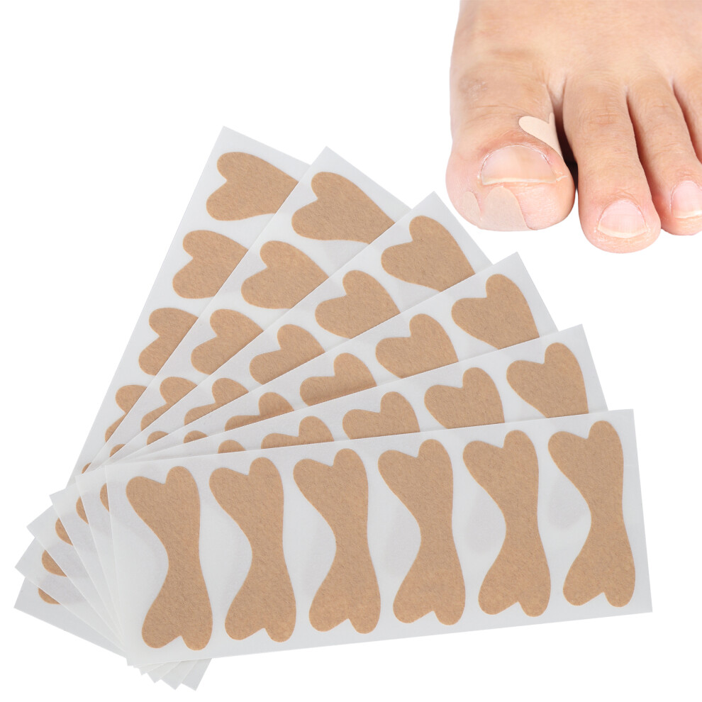 36pcs Ingrown Toenail Correction Patches, Foot Care Sticker Set