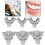 Professional Dental Tools, Smooth Surface Perforated Impression Trays, High-Grade Plastic For Safe Usage, Steady Flow Of Impression Material, Adjusta 6
