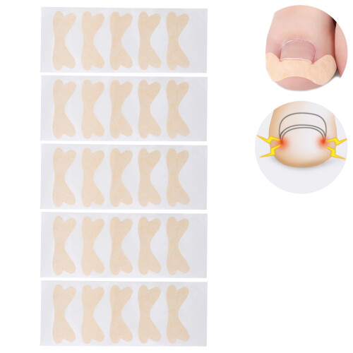 Lot de 25 patchs pour ongle incarné, taille 13  4,8 cm.